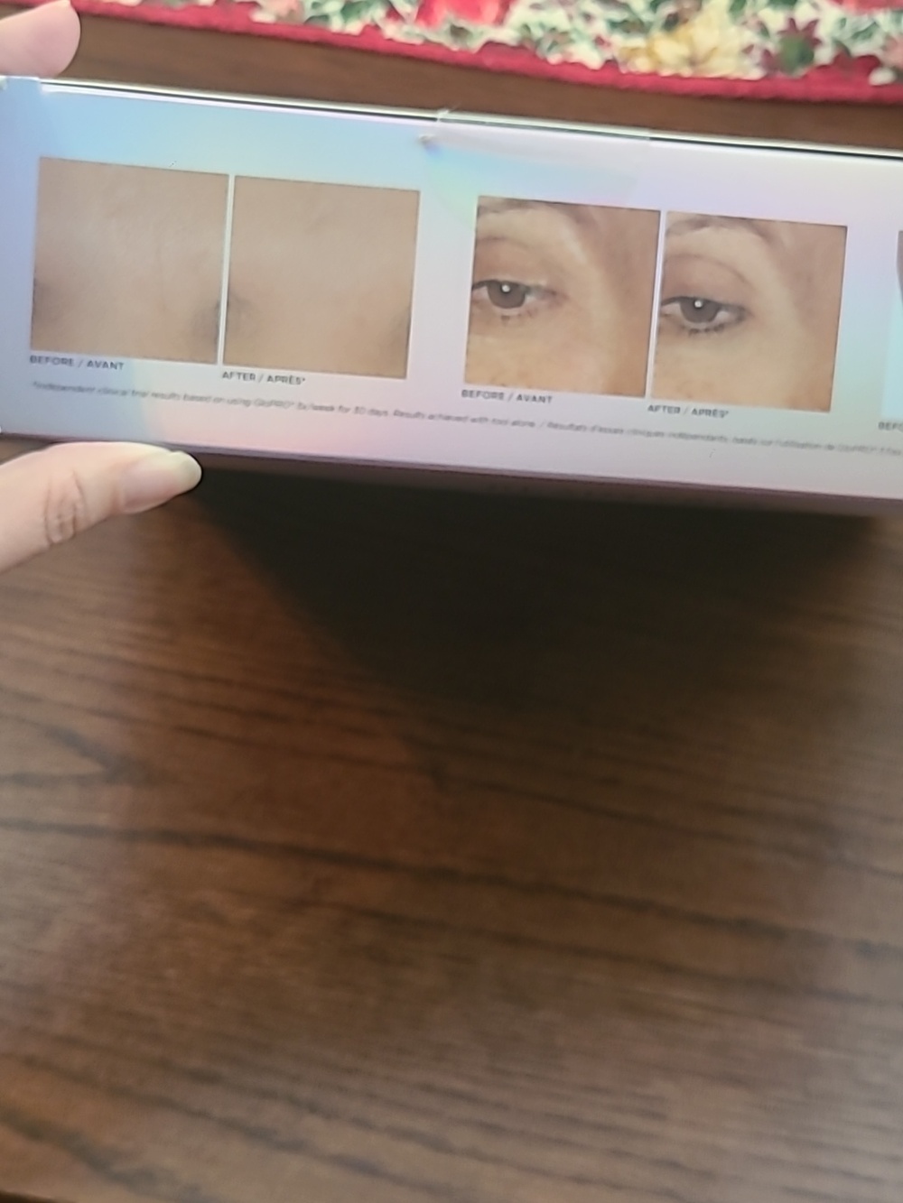 BEAUTYBIO Skin & Hair Goals Glopro Microneedling Kit - Iridescent - Picture 5 of 5